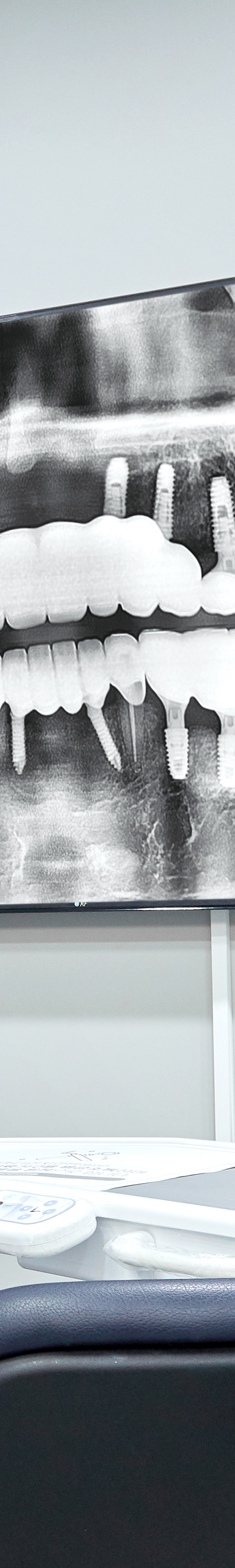 Mullae Station Dental Clinic — Sleep Implant Using Conscious Sedation image 44
