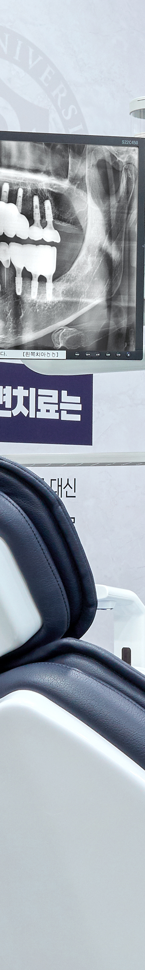 Yeongdeungpo Market Station Dental Clinic: Comfortable Under Conscious Sedation During Tooth Loss image 36