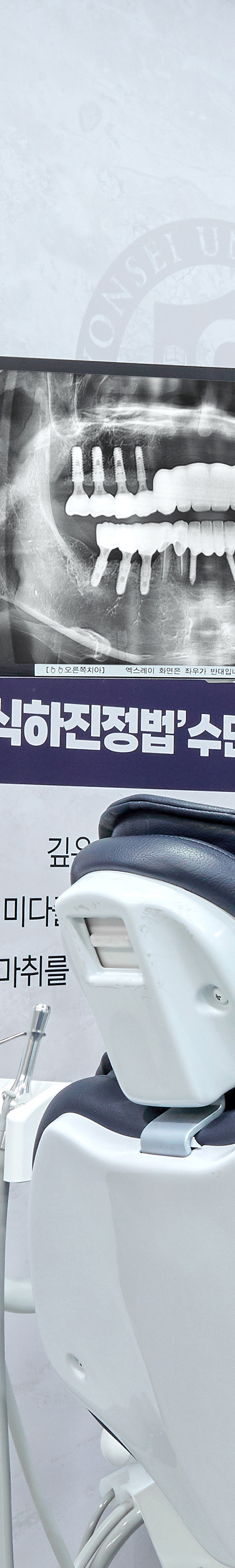합정동치과 임플란트시술 우수한 결과를 관련 이미지 39
