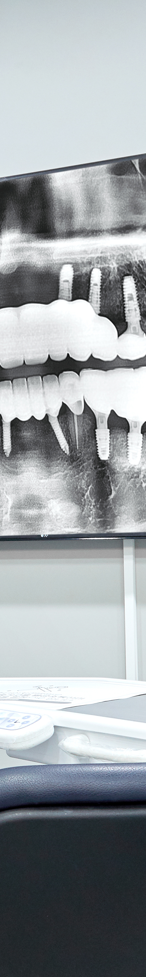 Yeongdeungpo Station Dental Clinic: Through Issuance of an Implant Management Certificate image 30