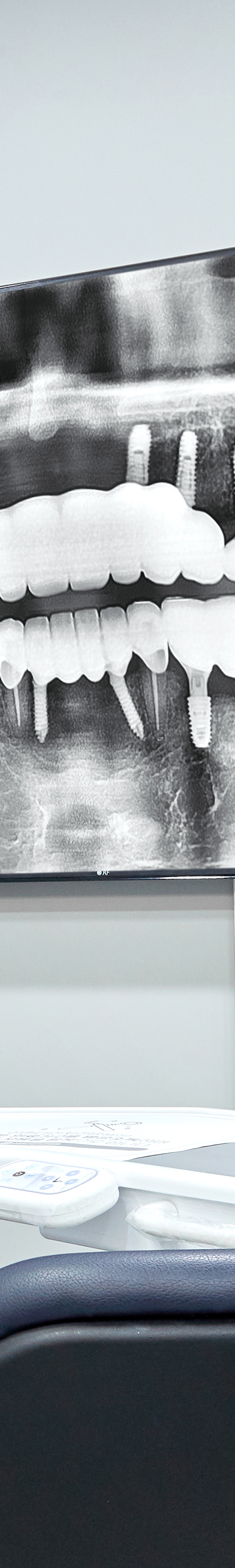 Yeouido Dental Clinic Implant Structure Similar to Natural Teeth image 44