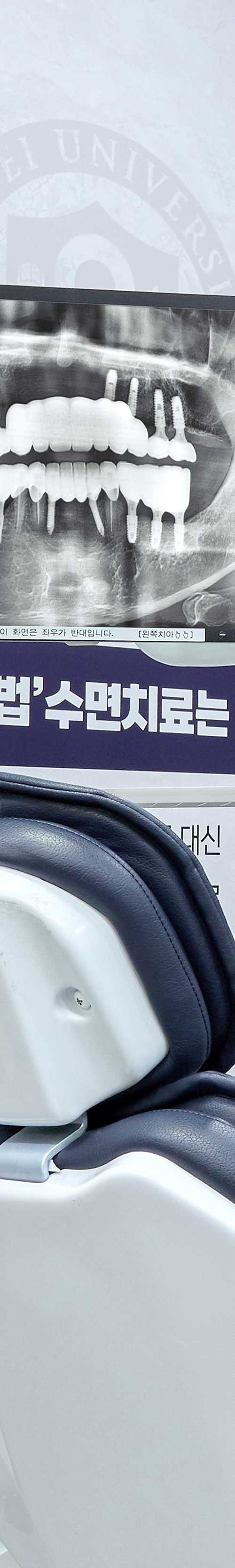 당산치과 의식하진정법 통해 편안한 임플란트 치료를 관련 이미지 19
