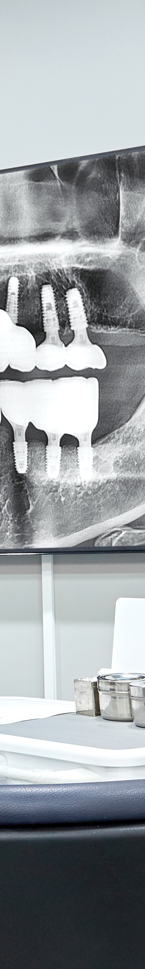 Yangpyeong Station Dental Clinic Implant Care with a Systematic Process image 25