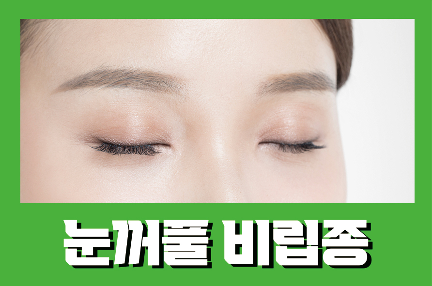 눈꺼풀비립종 어떻게 제거할 수 있을까 관련 이미지 1