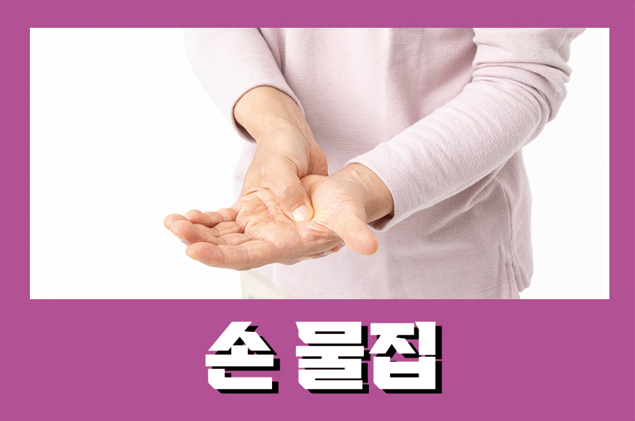손물집 발생하는 원인 3가지는 관련 이미지 1