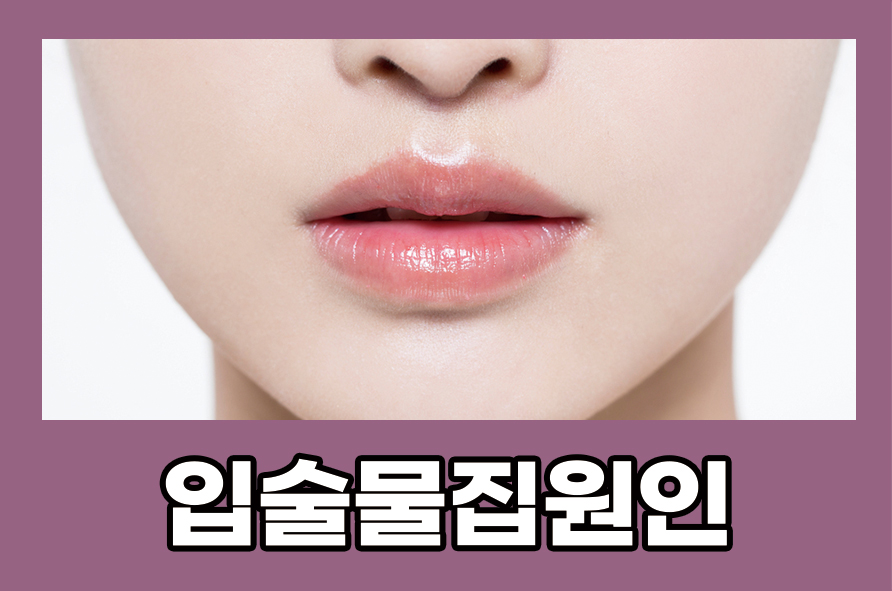 입술물집원인 헤르페스 증상과 예방법은 관련 이미지 1