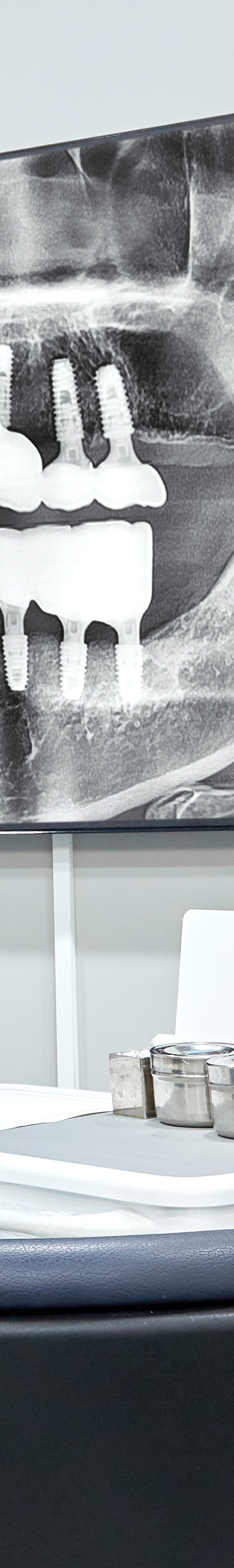 Mangwon-dong Dental Clinic: Comfortable Implant Procedures Through Conscious Sedation image 31