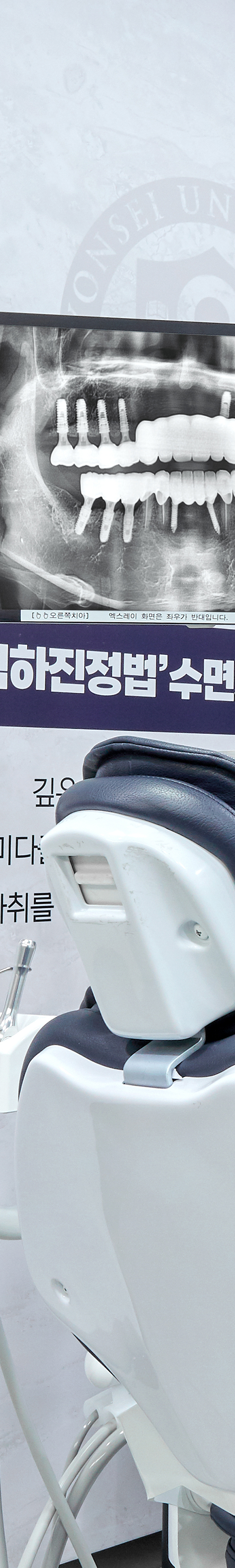 문래역치과 임플란트치료 개인에게 적절한 방법으로 관련 이미지 29