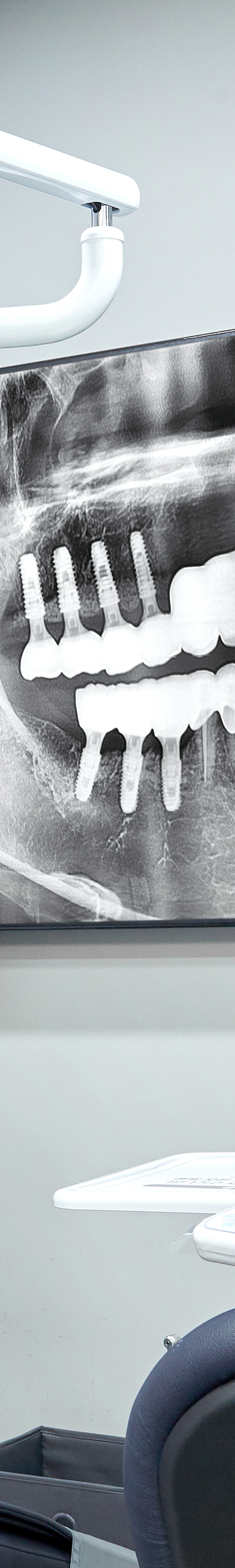 Yangpyeong-dong Dental Clinic: Treatment That Eases Concerns About Implant Procedures image 43