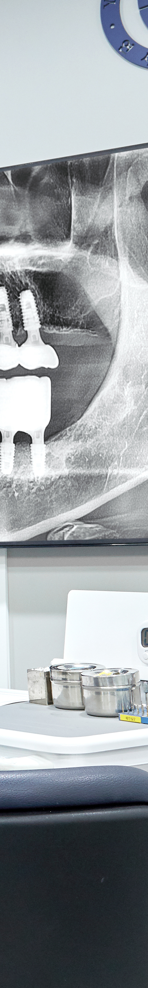 Dangsan Dental Clinic Implant Treatment in a Comfortable State image 41