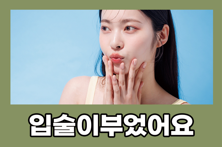 입술이부었어요 증상 원인에는 무엇이 있을까 관련 이미지 1