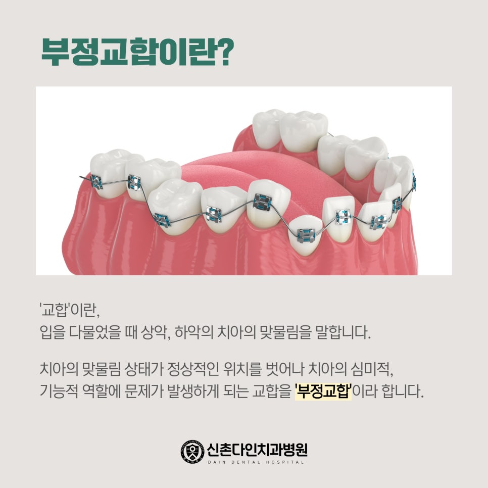 종로치과 치아교정 선택 신중해야 관련 이미지 2