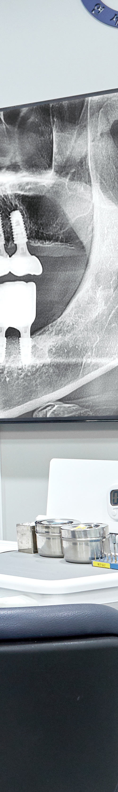 Dangsan Dental Clinic Implant Placement for Restoring Tooth Function image 25