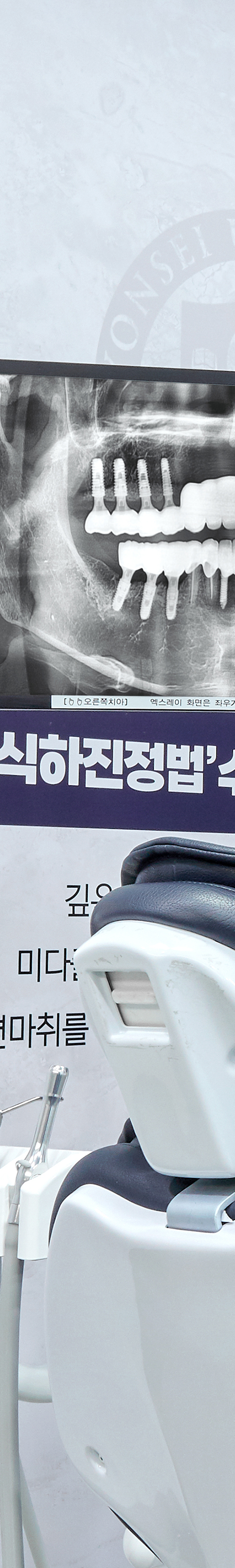 Dangsan Station Dental Clinic: Comfortable Sleep Implant Using Conscious Sedation image 19