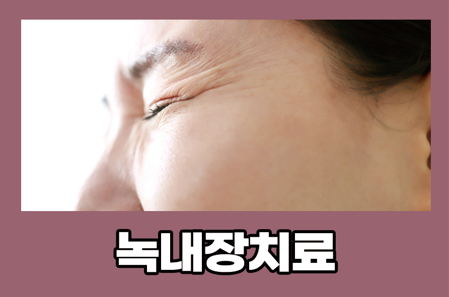 Learn About the Causes, Symptoms, and Management of Glaucoma Treatment image 1
