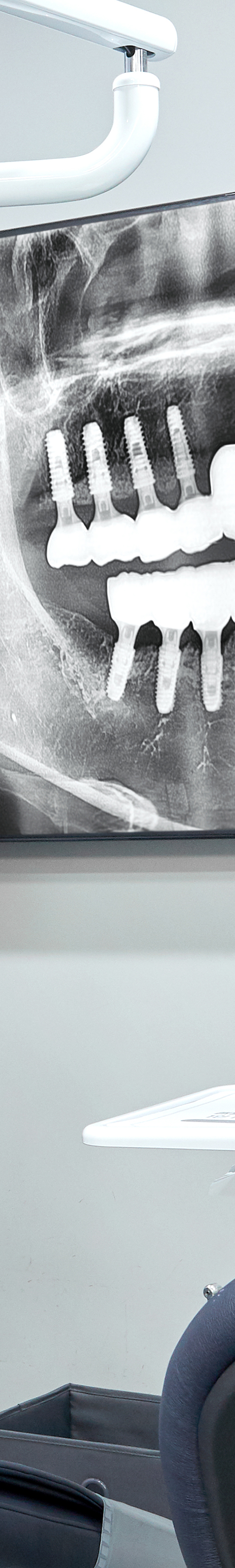 Mangwon-dong Dental Clinic: Comfortable Implant Procedures Through Conscious Sedation image 29