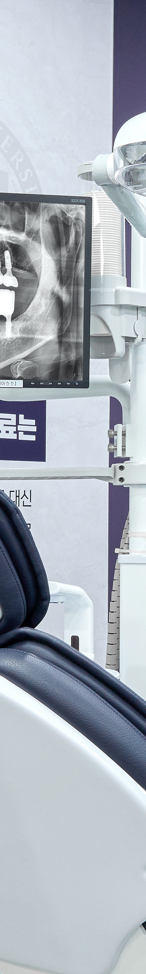 성산동치과 임플란트치료 안정성을 더한 시술을 관련 이미지 20
