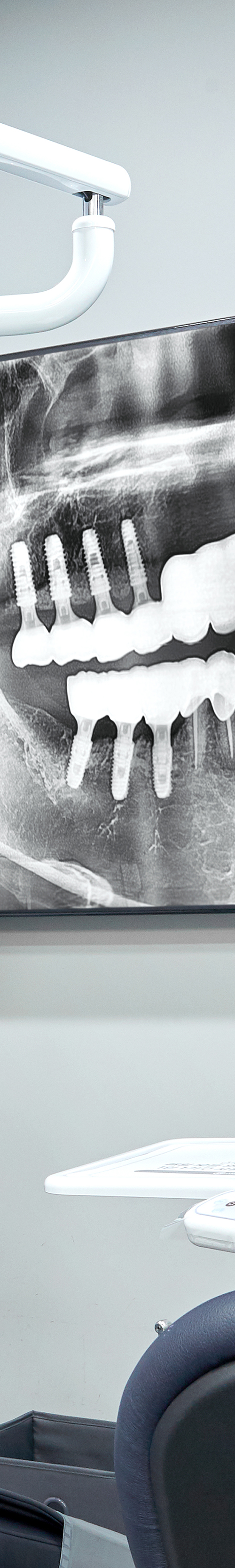 Mullae Station Dental Clinic — Sleep Implant Using Conscious Sedation image 43