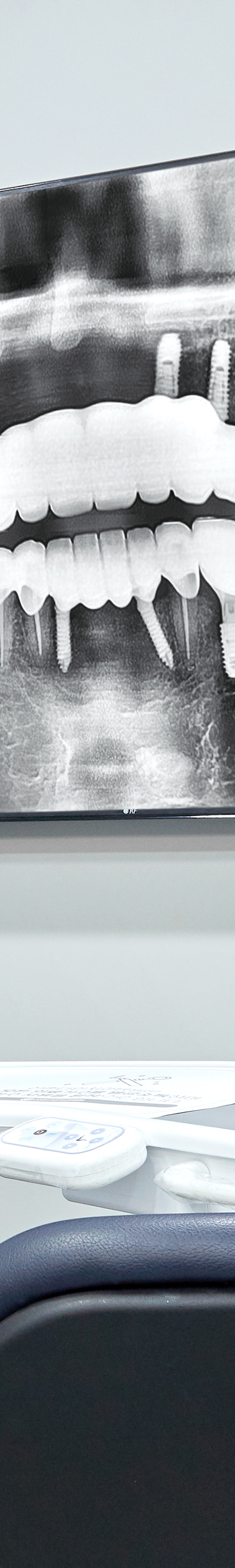 Dangsan-dong Dental Clinic: Thorough Implant Care with a Warranty Certificate image 34