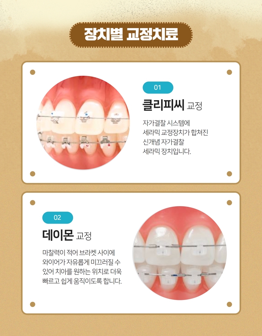 망원동치과 치아교정 꼭 해야할까? 관련 이미지 4