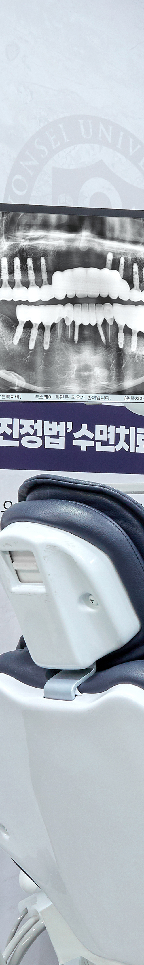 합정동치과 임플란트시술 세심한 치료 계획을 세워 관련 이미지 39