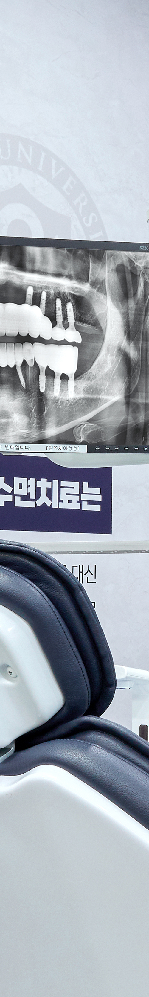 Dangsan Station Dental Clinic: Comfortable Sleep Implant Using Conscious Sedation image 20