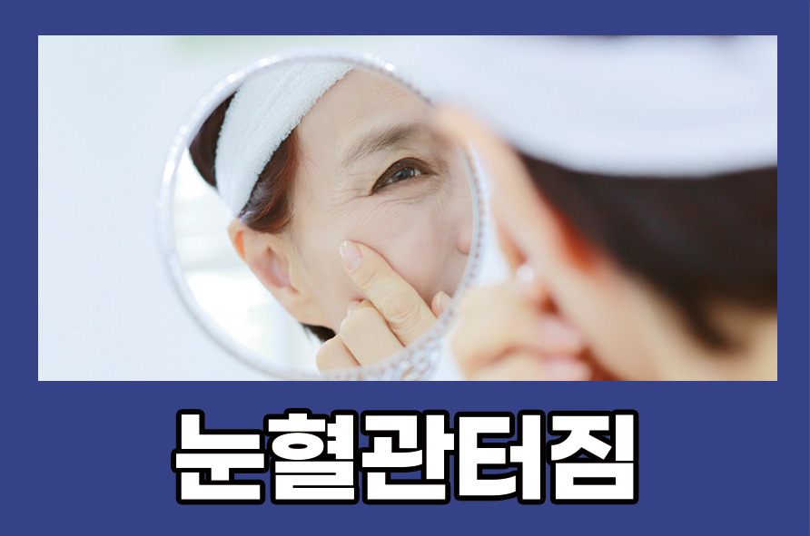 눈혈관터짐 원인과 증상 관리 및 예방법에는 관련 이미지 1
