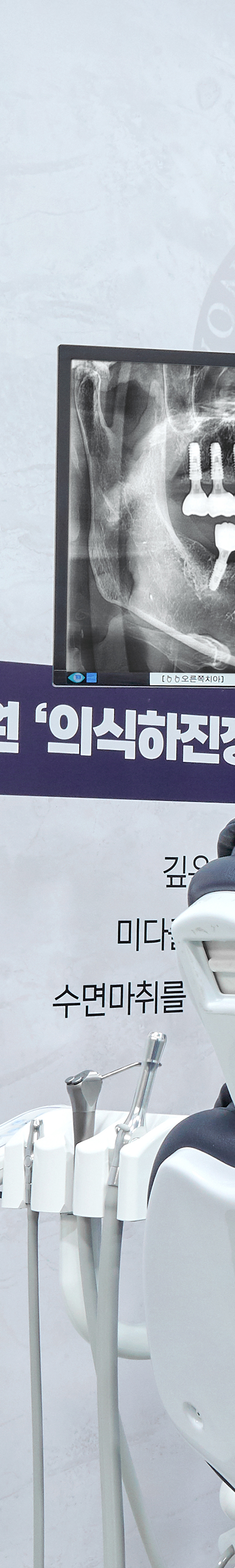망원동치과 임플란트시술 개인의 상태를 고려하여 관련 이미지 38