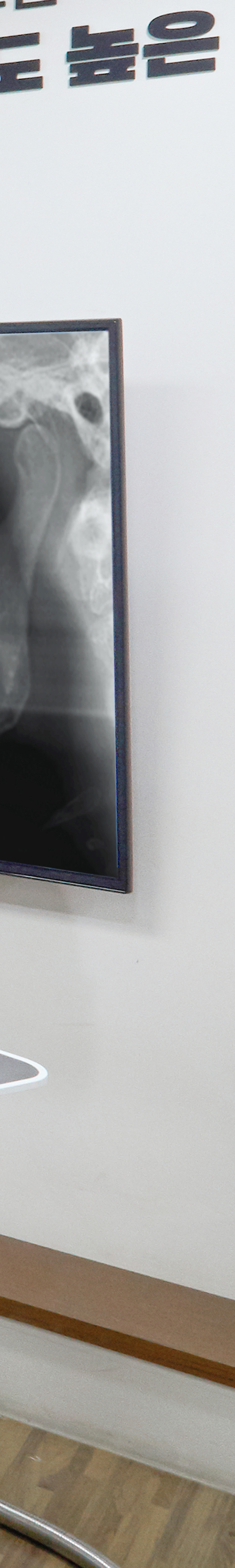 Dangsan Dental Clinic Implant Placement for Long-Term Use image 45