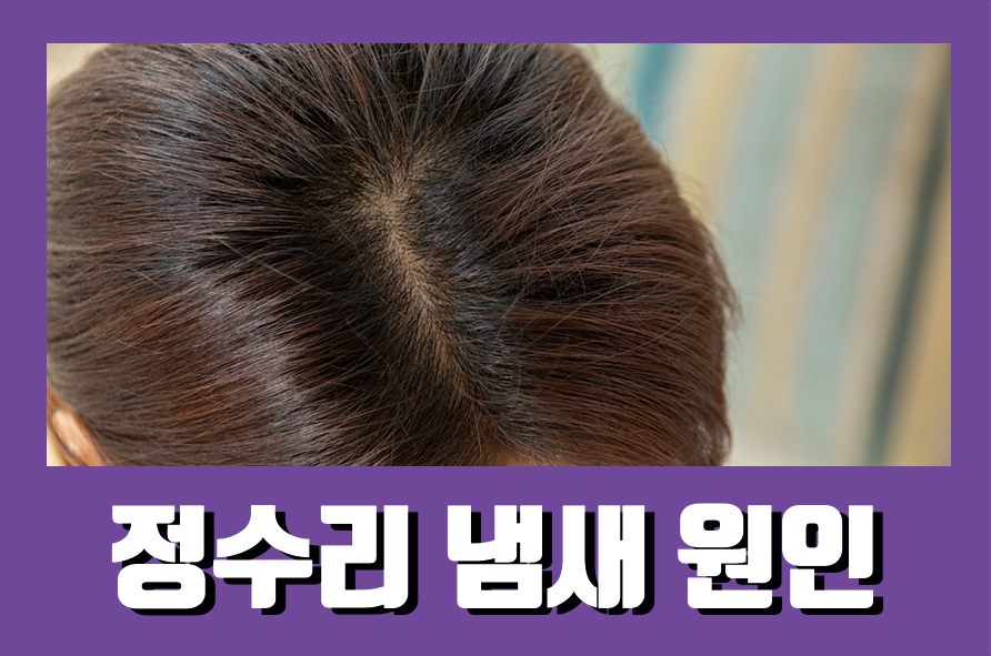 정수리냄새원인 심할 때 없앨 수 있는 방법 관련 이미지 1