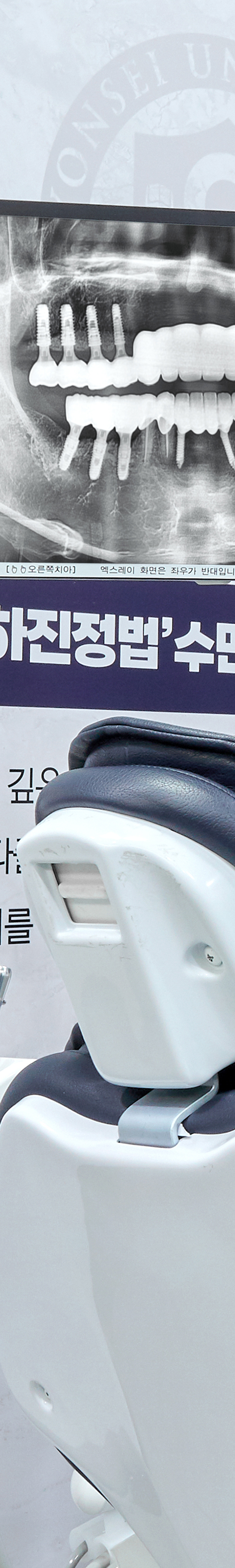 Yeongdeungpo Market Station Dental Clinic: Comfortable Under Conscious Sedation During Tooth Loss image 35