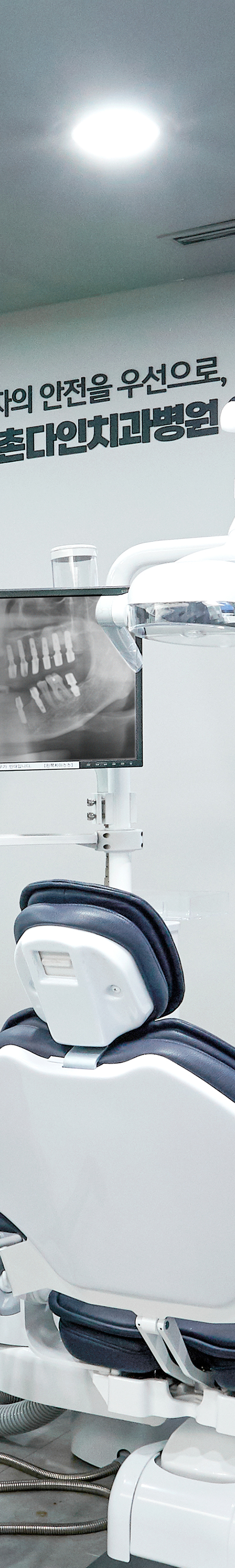 Yangpyeong-dong Dental Clinic: Treatment That Eases Concerns About Implant Procedures image 39