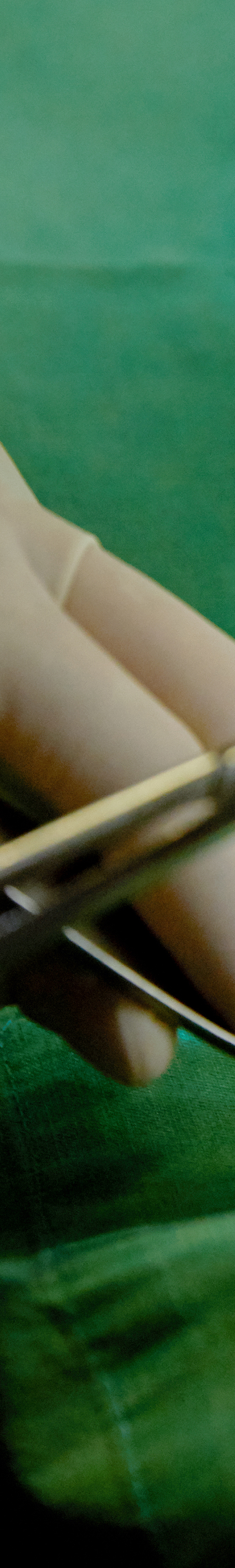 Shinchon Implant: To Help Prevent the Progression of Tooth Loss Symptoms image 36