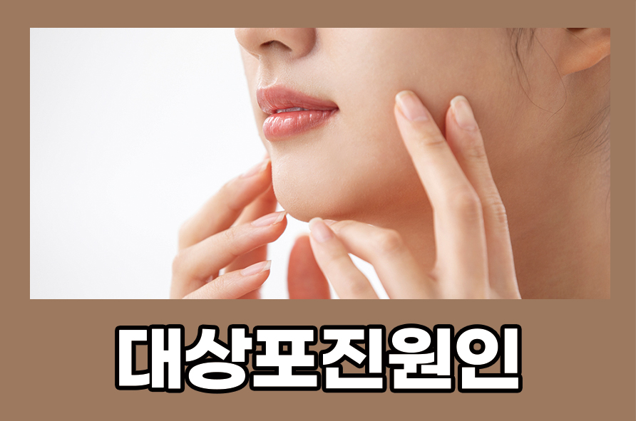 대상포진원인 및 증상 예방하는 방법 확인하기 관련 이미지 1