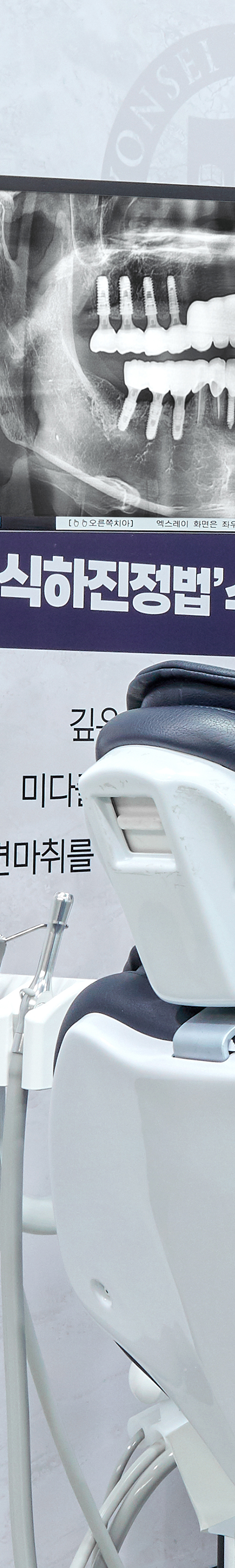 신촌사랑니 수면치료 의식하진정법으로 편안하게 관련 이미지 28