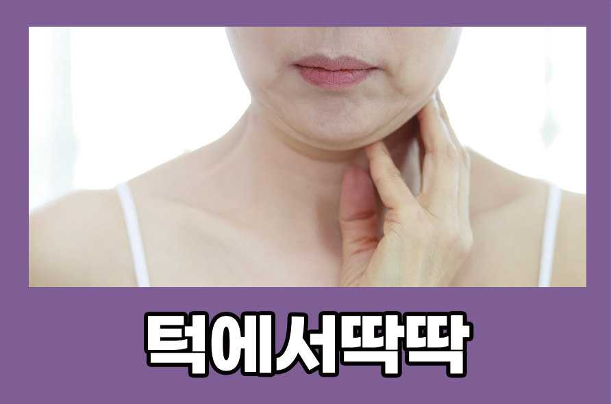 턱에서딱딱 턱관절 장애 원인 및 증상으로는 관련 이미지 1