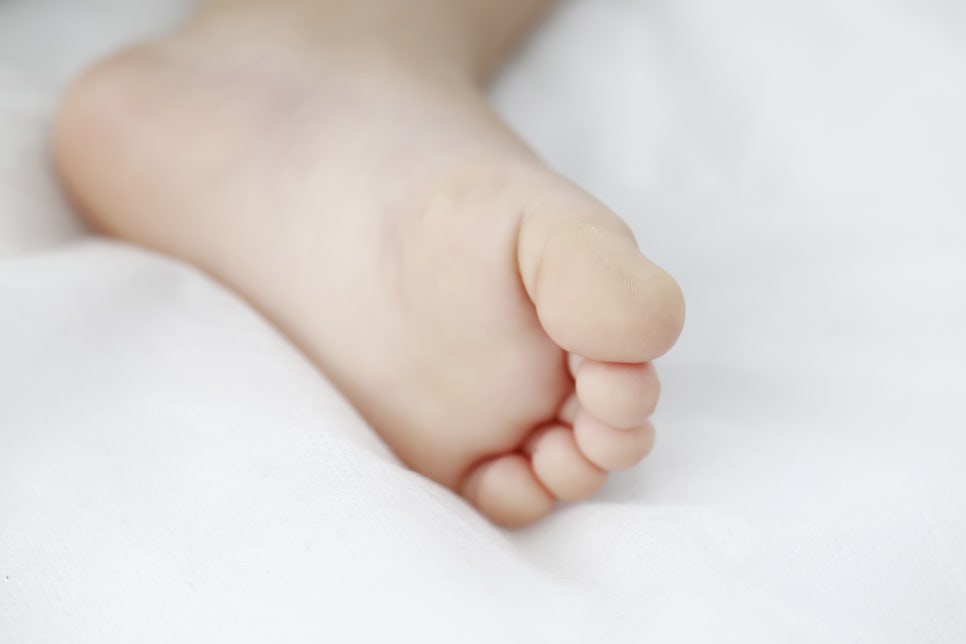 Morton's Neuroma in the Sole of the Foot: Causes, Symptoms, and Treatment for a Complete Cure image 2