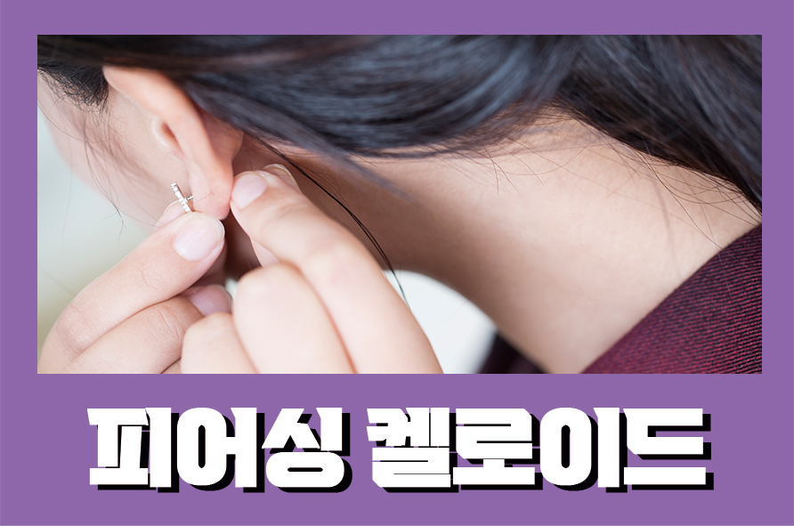 피어싱켈로이드 귀부음 염증 나타난다면 관련 이미지 1