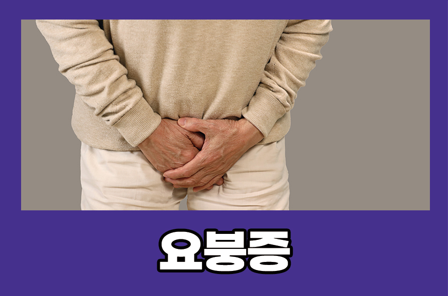 요붕증 원인, 증상 진단 방법과 치료 방법까지 관련 이미지 1