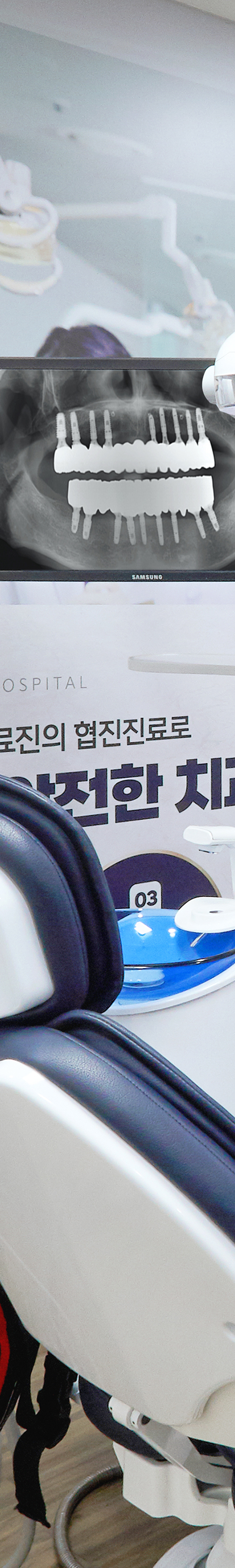 홍대입구역치과 임플란트관리 정기적인 검진을 통해 관련 이미지 29