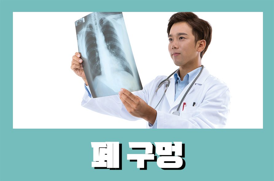 폐구멍 기흉이 의심된다면 치료와 예방법은 관련 이미지 1