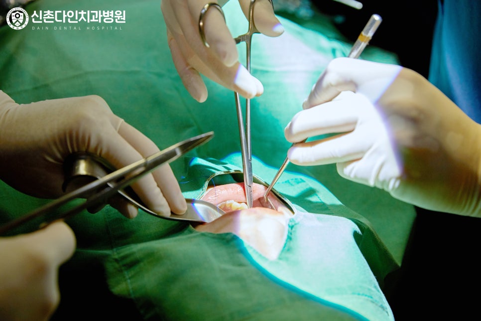 Shinchon Dental Clinic Implant Care Through a Careful Process image 7