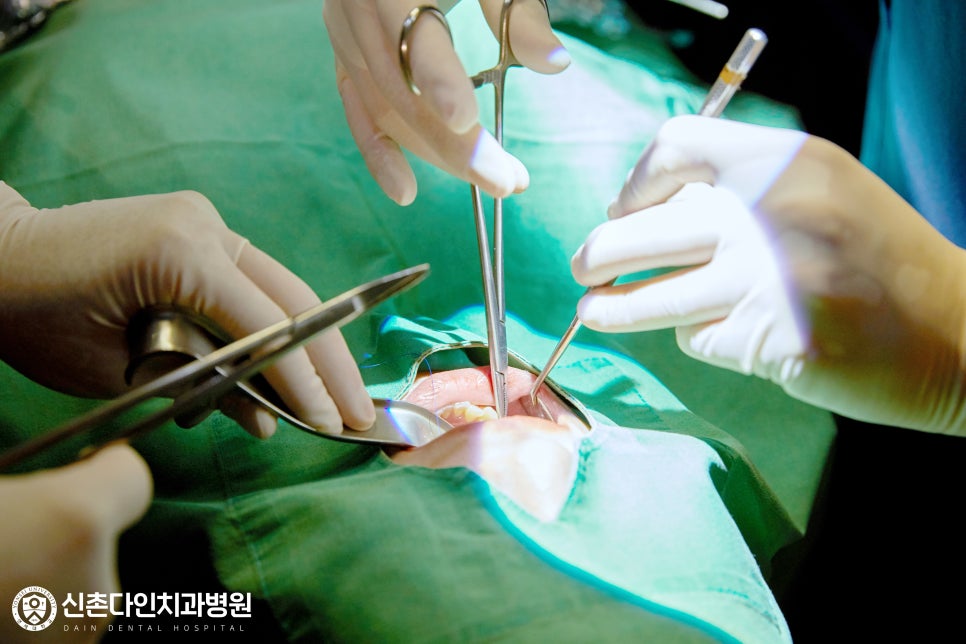 망원동치과 임플란트치료 세심한 계획으로 관련 이미지 6