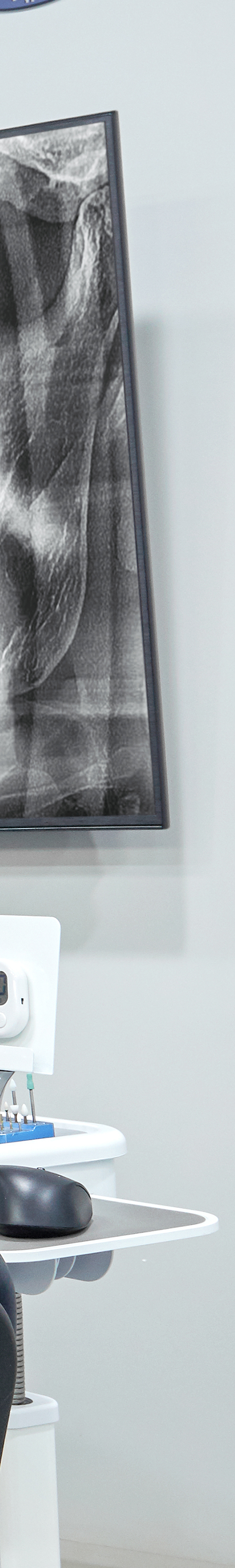 Treatment That Reduces Burden Through Conscious Sedation for Sinchon Dental Implants image 36