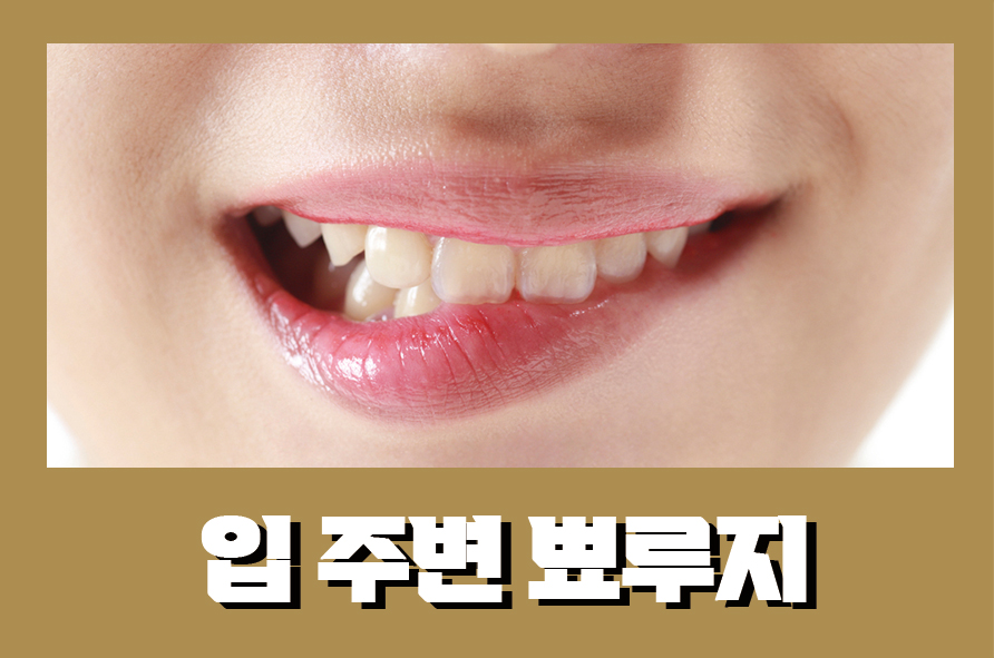 입주변뾰루지 발생위치에 따라 대처가 달라져요 관련 이미지 1