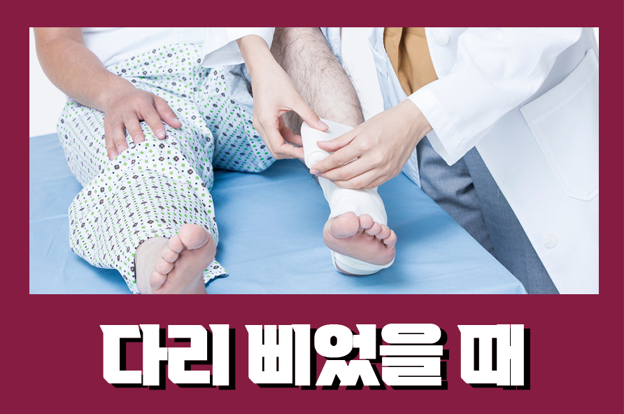 다리삐었을때 어떻게 대처하면 좋을까? 관련 이미지 1