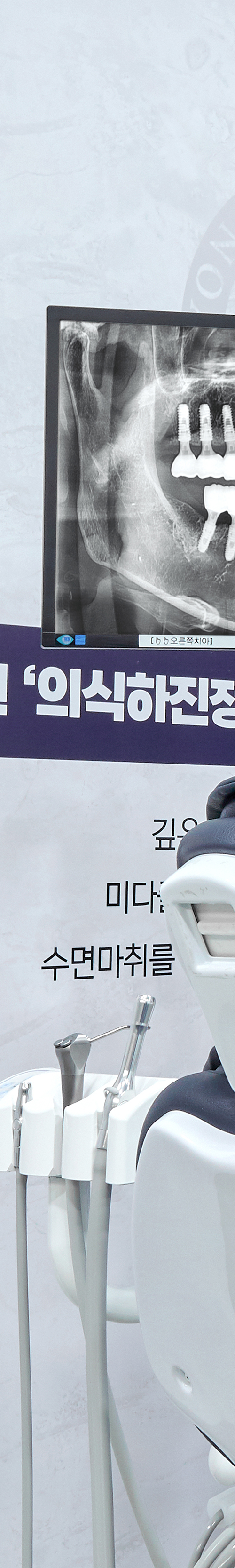 신촌역치과 임플란트치료 이후 섬세한 사후관리까지 관련 이미지 18