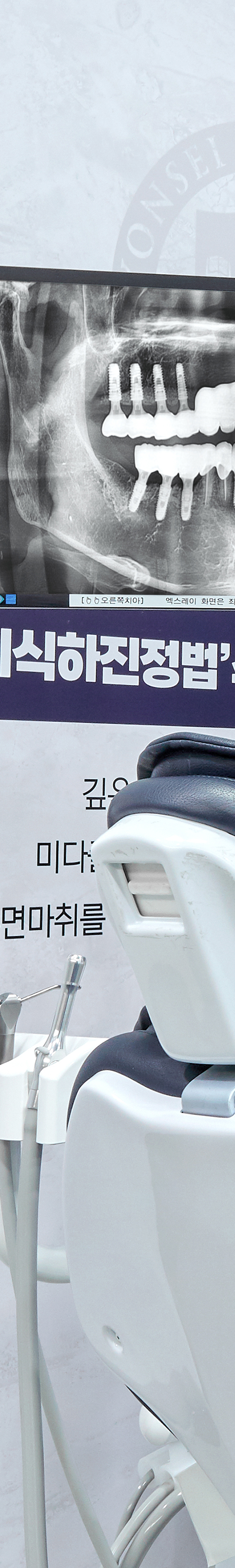 Treatment That Reduces Burden Through Conscious Sedation for Sinchon Dental Implants image 28
