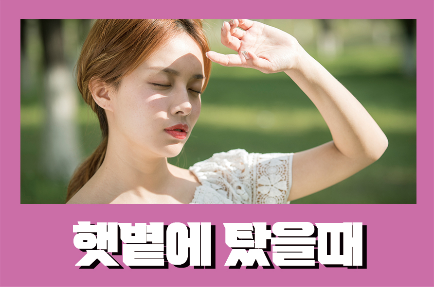 햇볕에탔을때 살이 가려울 때 대처방법 관련 이미지 1