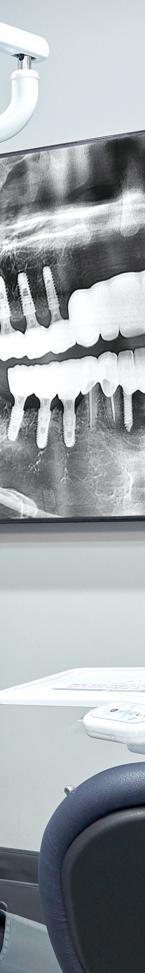 Treatment That Reduces Burden Through Conscious Sedation for Sinchon Dental Implants image 33